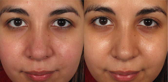 MAGE MD power-C serum