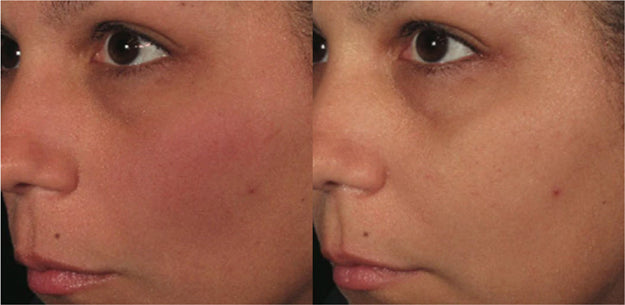 ORMEDIC balancing antioxidant serum