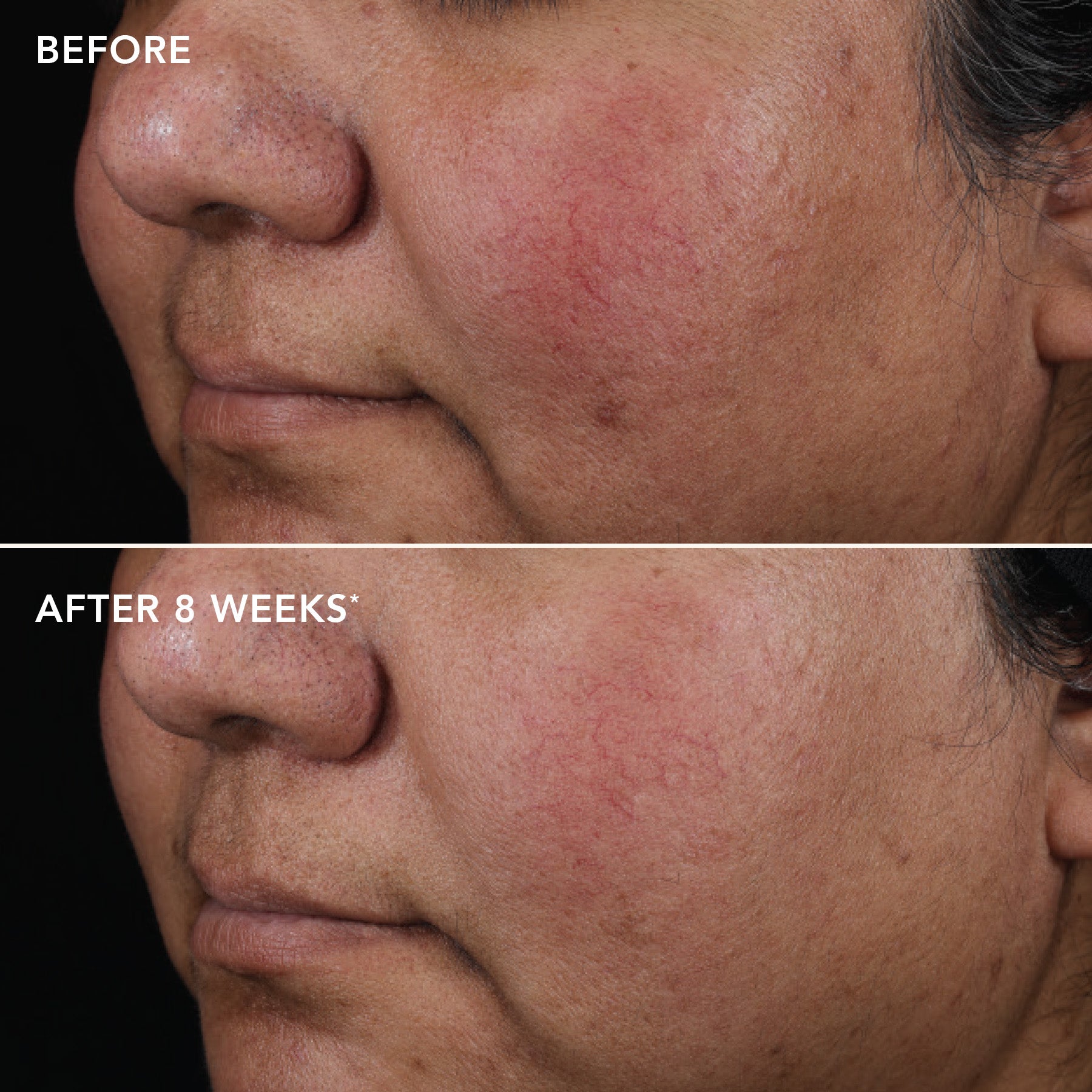 AGELESS+ retinol pure liquid retinol 0.75%